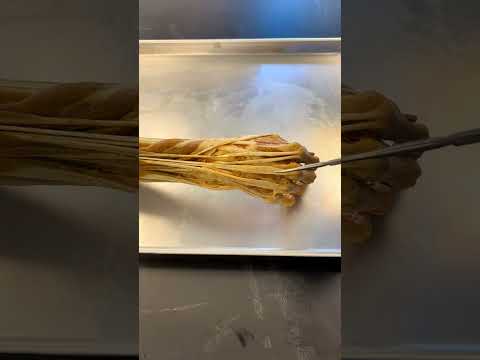 The Fascinating Structure and Function of the Human Arm