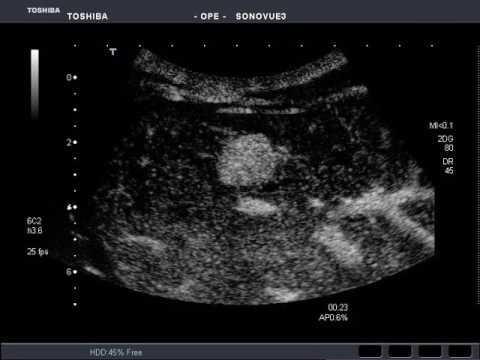 Innovations in FNH Radiology for Enhanced Patient Outcomes