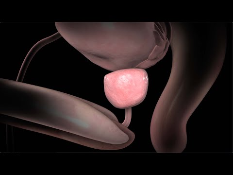 Prostate Gland Anatomy and Its Role in Male Health