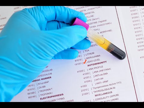 The Role of Forensic Toxicologists in Public Safety