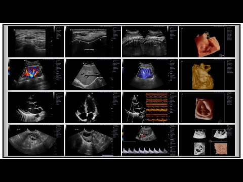 Local Advances in Ultrasound Imaging Technology