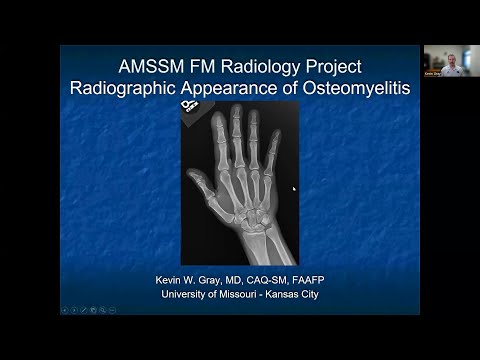The Role of X-rays in Diagnosing Osteomyelitis