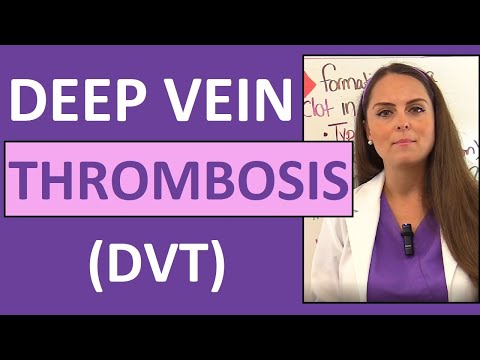 Pathophysiology of Deep Vein Thrombosis Uncovered