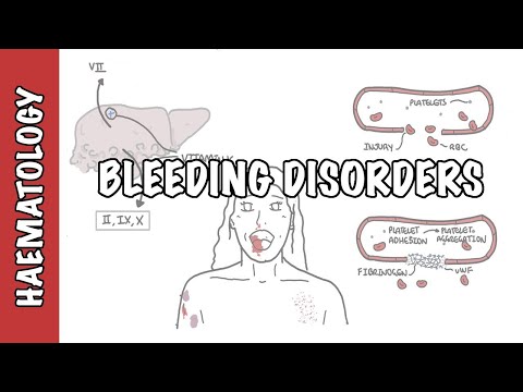 Pathophysiology of DIC: Mechanisms and Clinical Implications