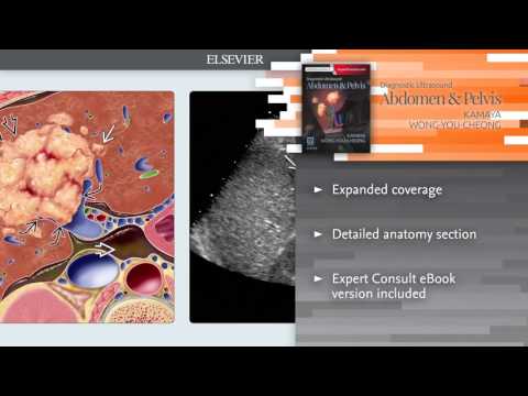 Advancements in Ultrasound Technology for Abdomen and Pelvis