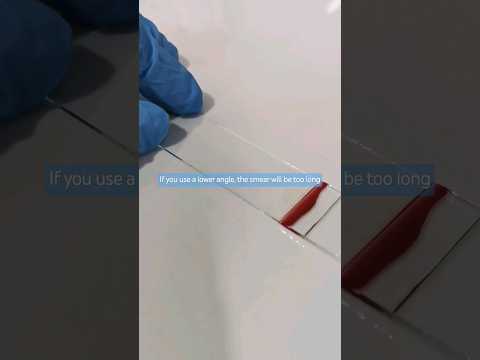 Advancing Clinical Pathology Labs Through Scientific Outreach