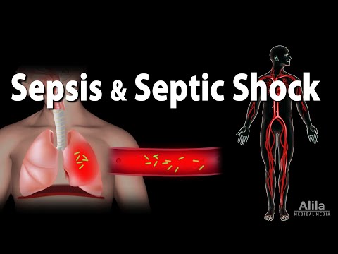 Pathophysiology of Septic Shock: Mechanisms and Implications