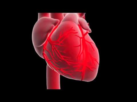 Acute Myocardial Infarction Pathophysiology Unraveled