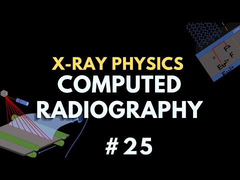 Advancements and Innovations in Computed Radiography