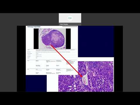 Advancements in Genetic Research Using MGI Mice Models