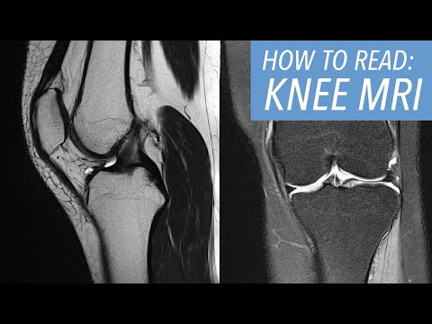 Knee MRI Anatomy Insights for Scientific Communication