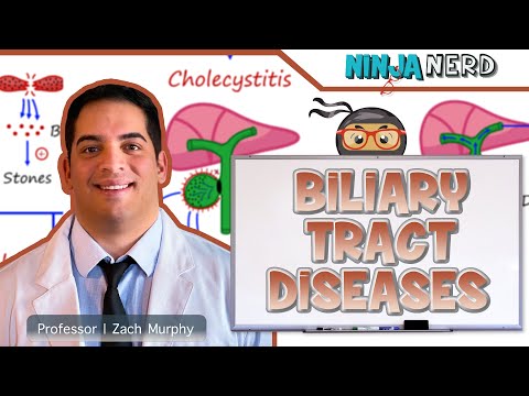 Pathophysiology of Choledocholithiasis and Its Implications
