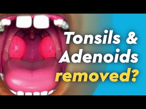 The Science Behind Tonsils and Their Role in Immunity