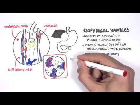 Gastrointestinal Bleeding Pathophysiology: Mechanisms and Implications