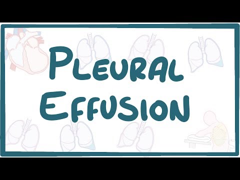 Pleural Effusion Pathophysiology and Its Clinical Significance