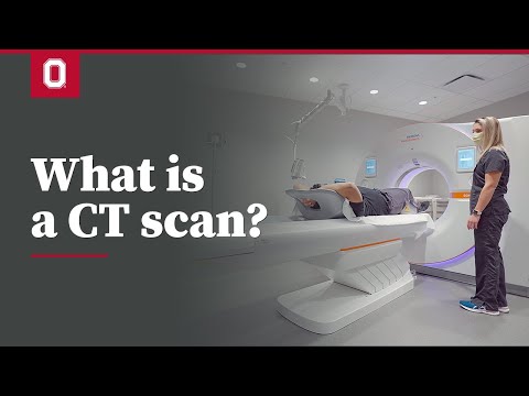 Advancements in Hip CT Scanning Technology and Applications