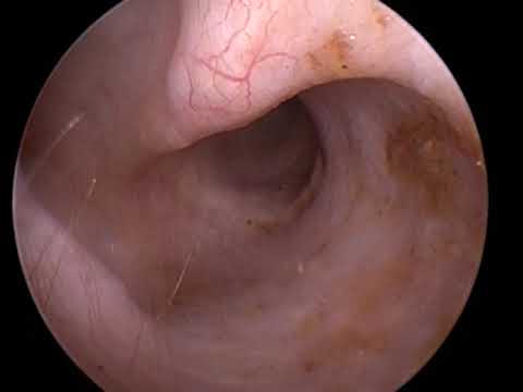 Anatomy of Canine Ears in Relation to Hearing and Health
