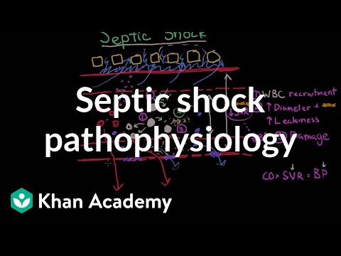 Pathophysiology of Septicemia: Mechanisms and Implications