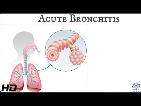 Bronchitis Pathophysiology: Mechanisms and Implications