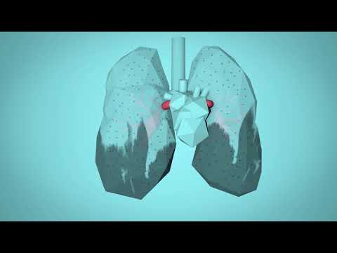 Air Pollution's Effects on Health and Environment Explained