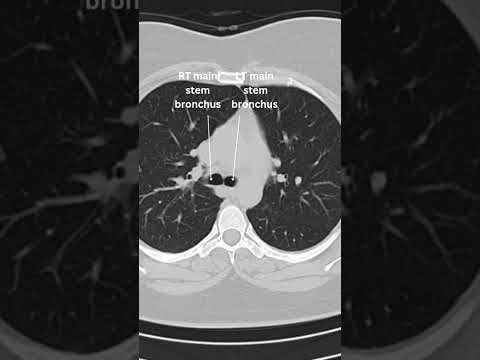 Unraveling the Complexities of Chest Anatomy in Science