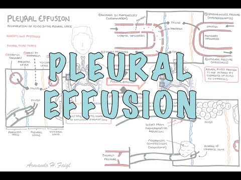 Cytology and Its Role in Diagnosing Pleural Effusion