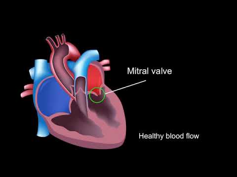 Pathophysiology of Rheumatic Heart Disease in Medical Research