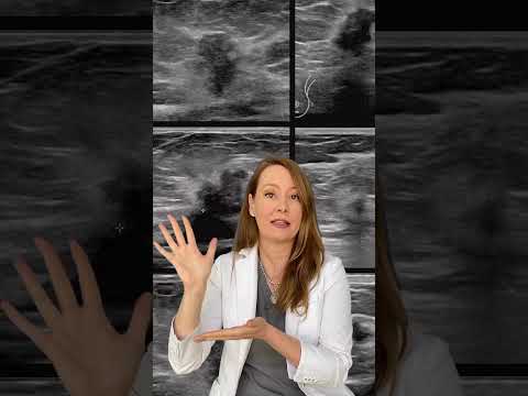 Radiologic Features of Breast Hamartomas in Clinical Practice