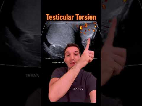 Radiological Insights into Testicular Torsion Diagnosis