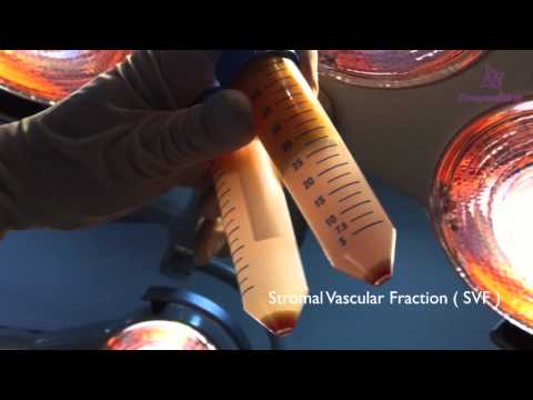 Harnessing Adipose Stem Cells for Regenerative Medicine