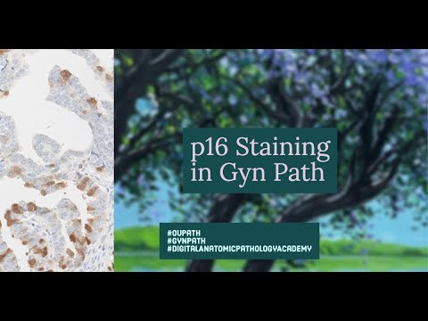 P16 Pathology Outlines for Advancing Scientific Knowledge