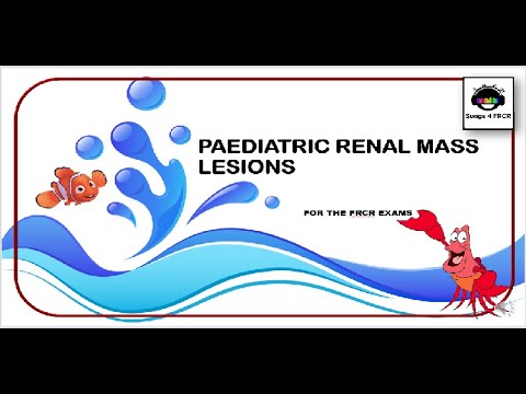 Mesoblastic Nephroma in Radiology: Case Studies and Insights