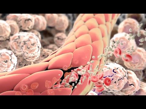 Inflammation's Role in Pathology and Disease Mechanisms
