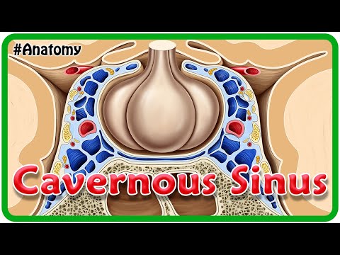 Cavernous Sinus Thrombosis: Radiological Insights and Findings