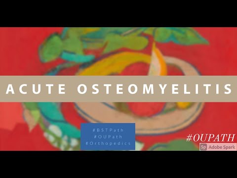 Histological Insights into Osteomyelitis Pathophysiology