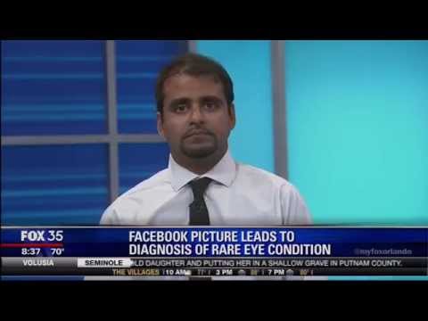 Coats Disease in Radiology: Advances in Diagnosis and Treatment