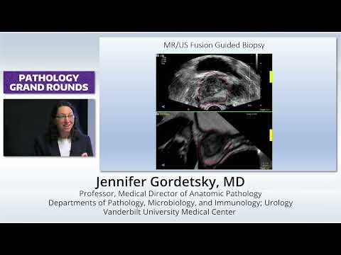 NKX3-1 Pathology Outlines and Their Scientific Implications
