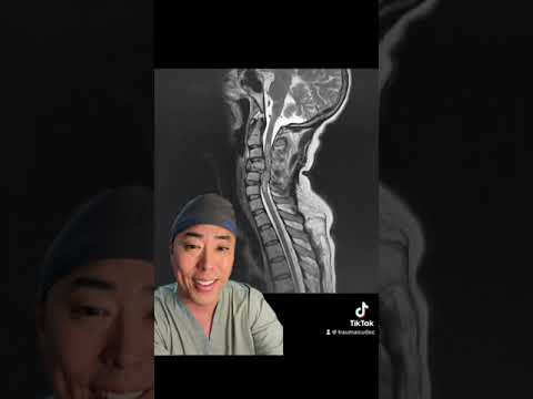 Neurogenic Shock Pathophysiology: Mechanisms and Implications