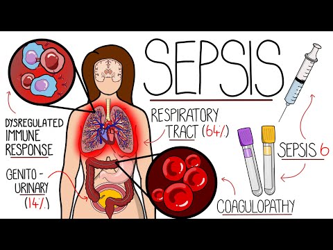 Urosepsis Pathophysiology: Mechanisms and Implications