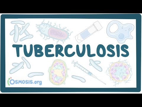 Histological Insights into Tuberculosis Pathology and Diagnosis