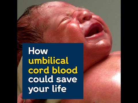 The Science Behind the Benefits of Saving Cord Blood