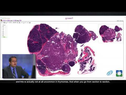 Thymoma Pathology Insights for Scientific Collaboration