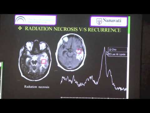 Advancements in MR Spectroscopy for Radiological Practice