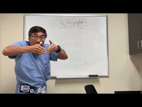 Histological Features of Whipple Disease: A Scientific Insight