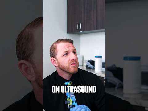 Radiological Insights into Osteitis Pubis Diagnosis and Care