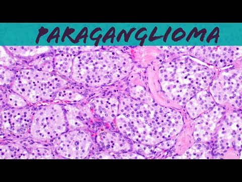 Histological Features of Pheochromocytoma Tumors