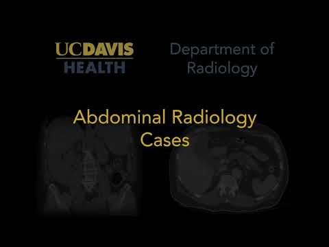 Situs Inversus in Radiology: A Scientific Perspective