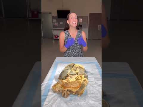 Right Side Anatomy: Insights into Human Body Functionality