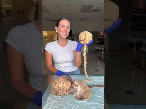 Fascinating Anatomy Drawings of the Female Body in Science