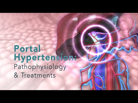 Pathophysiology of Portal Hypertension and Its Consequences